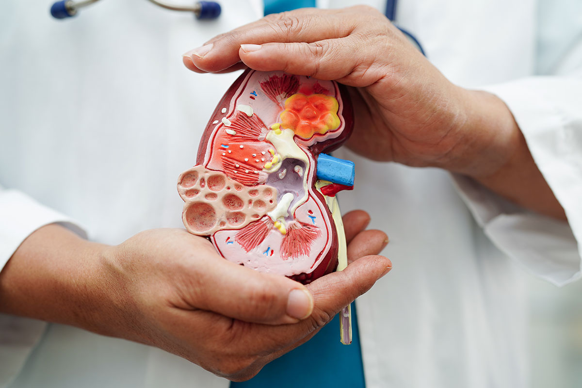 kidney diagram